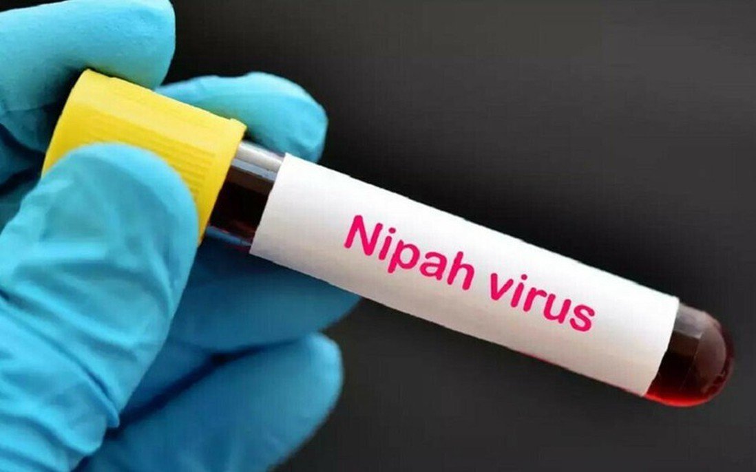 14-1771087487-moi-de-doa-dai-dich-moi-tu-virus-nipah-va-canh-bao-khan-tu-bo-y-te.jpg