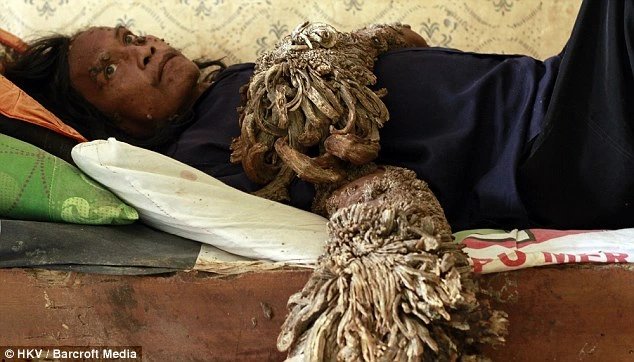 17-1773733262-vinh-biet-nguoi-cay-indonesia-42-nam-can-truong-chong-choi-dinh-menh-va-uoc-mo-tho-moc-dang-do