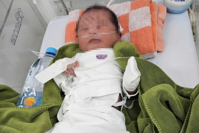 Be-gai-bi-bo-o-vuon-cao-su-3