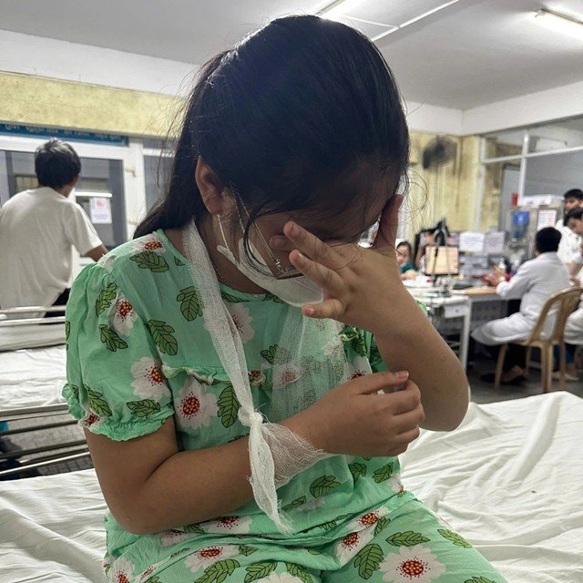 21-1774056001-hue-co-giao-dung-thuoc-go-danh-hoc-sinh-lop-4-gay-tay-nhap-vien-gia-dinh-he-lo-nguon-con-su-viec