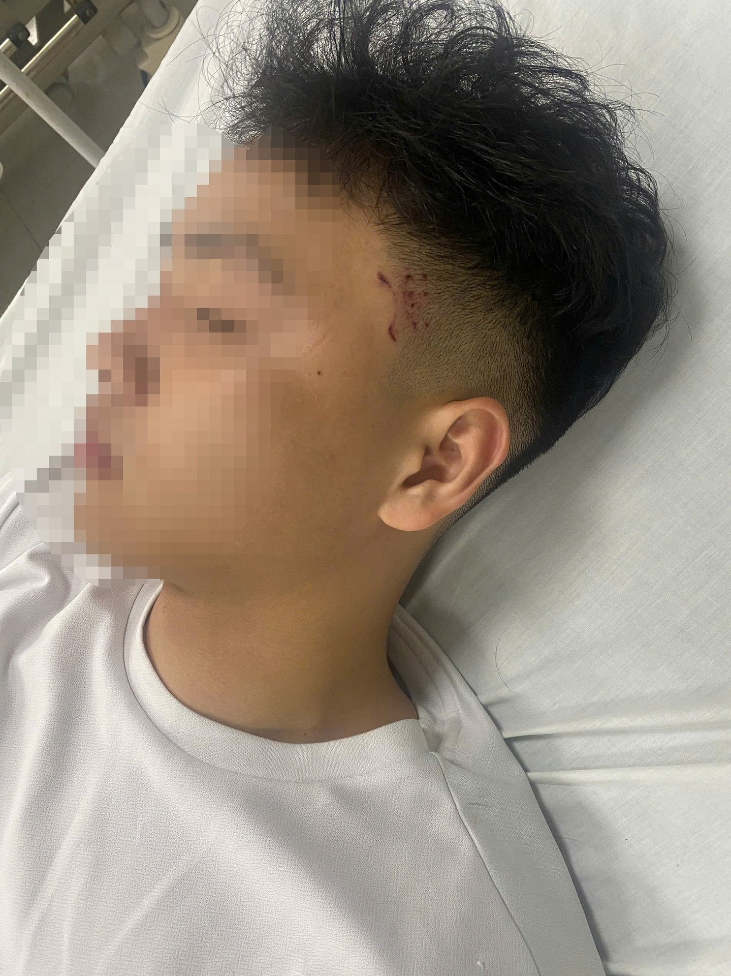 29-1774753187-ha-noi-xac-minh-vu-nam-sinh-bi-hanh-hung-giua-dem