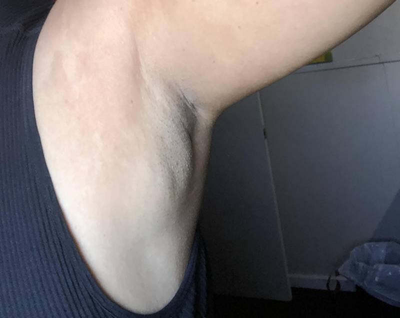 07-1775530532-bi-kich-co-gai-22-tuoi-nhan-ket-luan-ung-thu-sau-mot-nam-bi-coi-la-bat-on-tam-ly