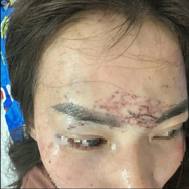 10-1775825895-vu-co-gai-ngoai-tinh-bi-nguoi-vo-xam-len-mat-va-gay-thuong-tich-nang-khang-cao-toan-bo-ban-an