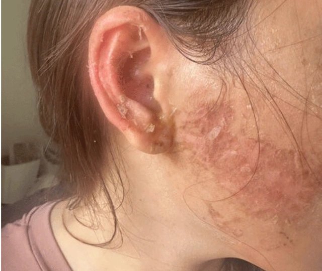 10-1775825895-vu-co-gai-ngoai-tinh-bi-nguoi-vo-xam-len-mat-va-gay-thuong-tich-nang-khang-cao-toan-bo-ban-an