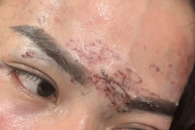 10-1775825895-vu-co-gai-ngoai-tinh-bi-nguoi-vo-xam-len-mat-va-gay-thuong-tich-nang-khang-cao-toan-bo-ban-an