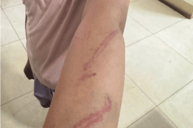 14-1776148640-vu-con-gai-9-tuoi-nghi-bi-me-ruot-tac-dong-vat-ly-34-vet-bam-nguoi-bo-tiet-lo-loat-tinh-tiet-gay-bat-ngo