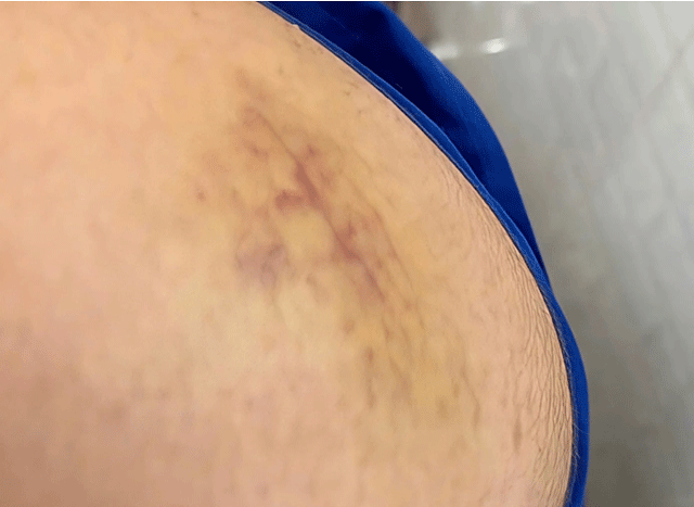 Ga-dan-ong-danh-nam-thanh-nien-3