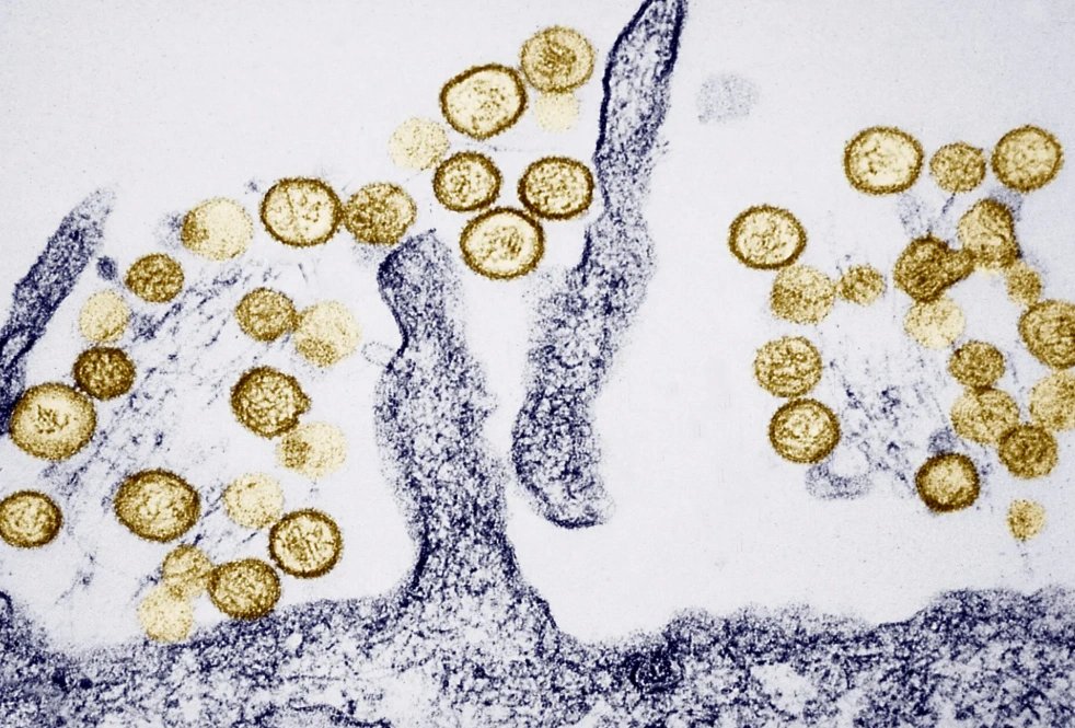 04-1777863482-tham-kich-tren-du-thuyen-dai-tay-duong-3-hanh-khach-tu-vong-do-virus-tu-loai-gam-nham