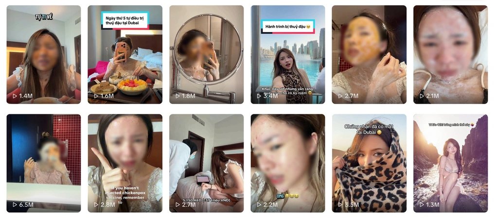 13-1778639613-vu-tiktoker-chany-mac-thuy-dau-tai-dubai-thu-hut-hang-trieu-luot-xem-dieu-bac-si-lo-nhat-khong-phai-cac-not-mun-nuoc
