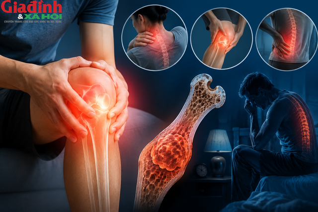 Đau xương về đêm ngày càng nhiều, dấu hiệu cảnh báo không nên bỏ qua - Ảnh 3.