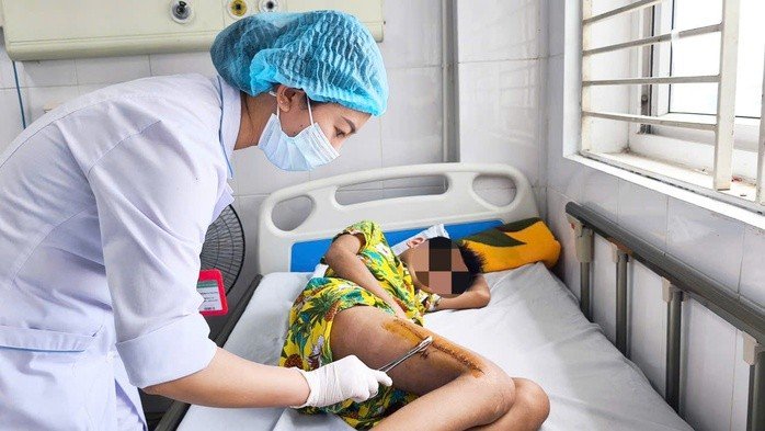 Sốt cao, đau chân, bé trai 11 tuổi suýt tàn phế vì tụ cầu vàng - Ảnh 1.