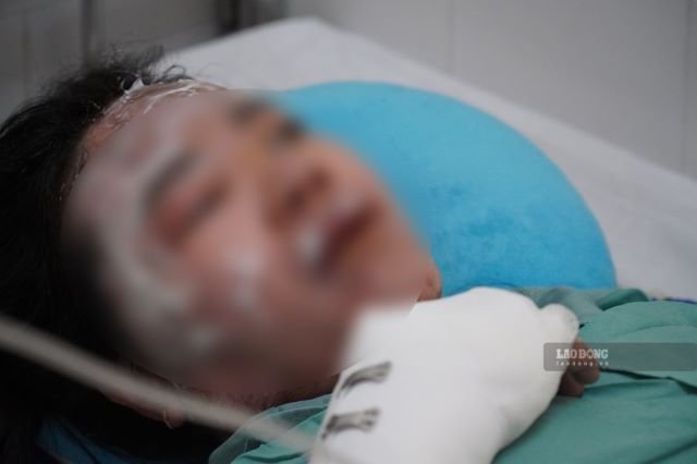 23-1784766009-vu-chay-xe-khach-lam-7-nguoi-tu-vong-o-dong-nai-nan-nhan-tiet-lo-chi-tiet-bat-thuong-khi-thoat-hiem