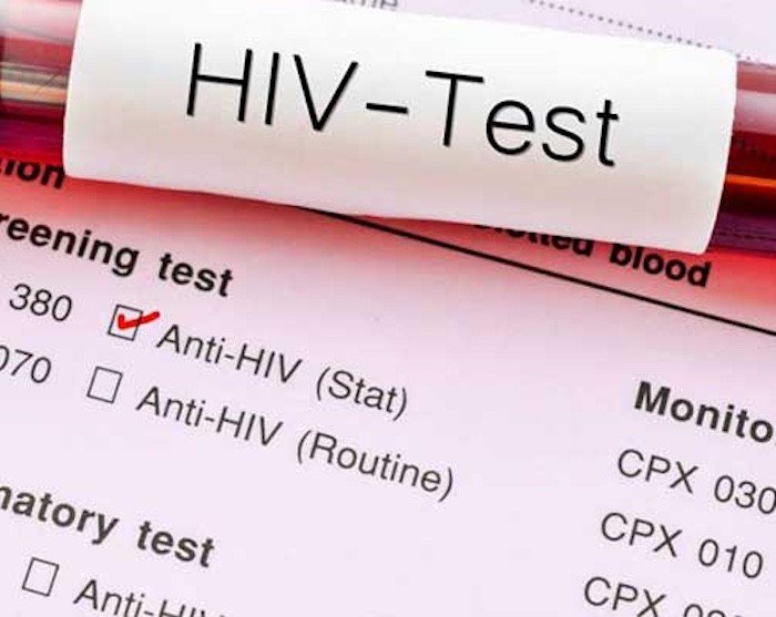 20-1787188075-loi-song-chuan-muc-van-mac-hiv-nu-nghien-cuu-sinh-27-tuoi-tiet-lo-nguyen-nhan-khien-ai-cung-soc