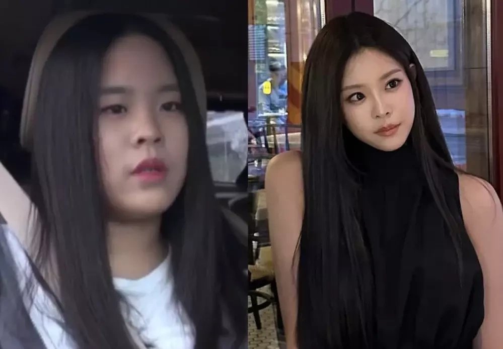 Woo Seo Yoon ở show truyền hình thời niên thiếu (trái) và hiện tại.
