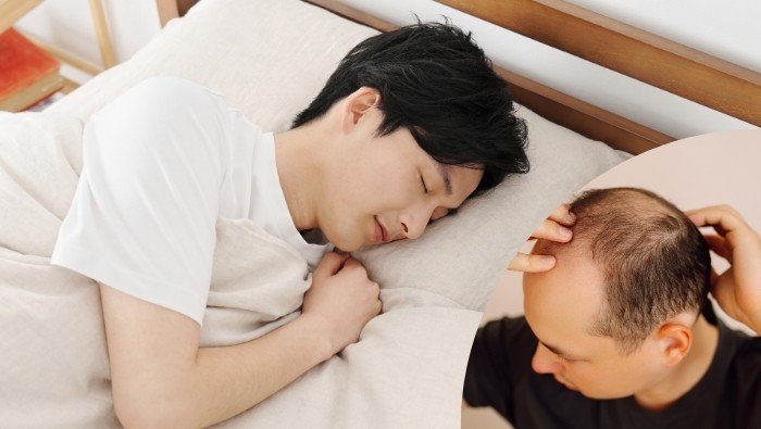 Ma sát và sự mài mòn cơ học giữa tóc và vỏ gối cotton khiến sợi tóc dễ bị gãy rụng