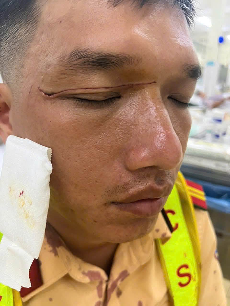 chong nguoi thi hanh cong vu 3.png