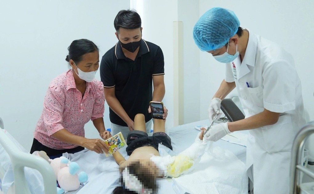Bé gái 4 tuổi bị đứt rời cánh tay sau tai nạn áo chống nắng cuốn vào bánh xe