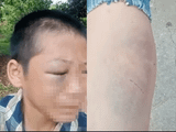 Đọc nhanh bài viết #1171870