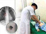 Đọc nhanh bài viết #1182350