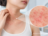 Đọc nhanh bài viết #1192059