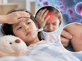 4 học sinh mắc não mô cầu, 1 em tử vong: Những dấu hiệu cha mẹ tuyệt đối không nên bỏ qua