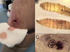 Đọc nhanh bài viết 1029158