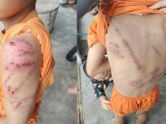 Đọc nhanh bài viết 1029203