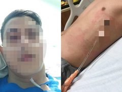 Đọc nhanh bài viết 1029526