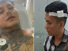 Đọc nhanh bài viết 1029883