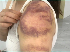 Đọc nhanh bài viết 1030765