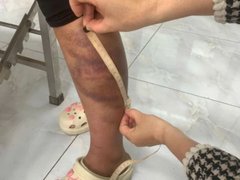 Đọc nhanh bài viết 1030857