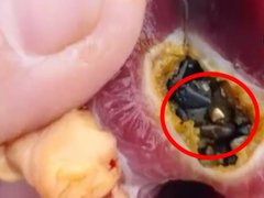 Đọc nhanh bài viết 1031688