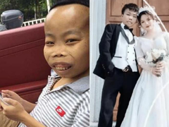 Đọc nhanh bài viết 1031925