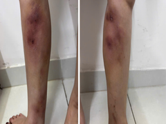 Đọc nhanh bài viết 1032071