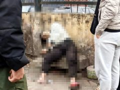 Đọc nhanh bài viết 1032238