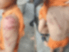 Đọc nhanh bài viết 1032829