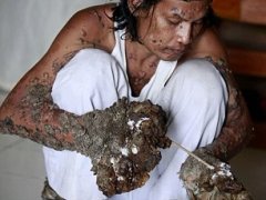 Đọc nhanh bài viết 1032842