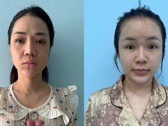 Đọc nhanh bài viết 1033458