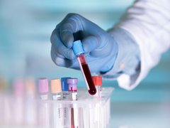 Đọc nhanh bài viết 1033879