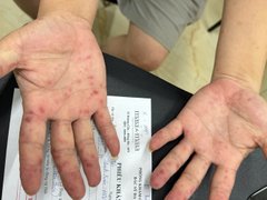 Đọc nhanh bài viết 1034109