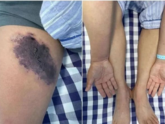 Đọc nhanh bài viết 1035018