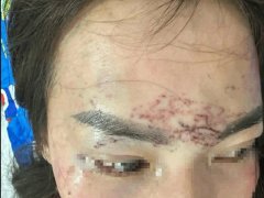 Đọc nhanh bài viết 1035514