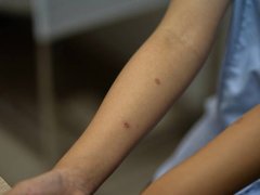 Đọc nhanh bài viết 1035580