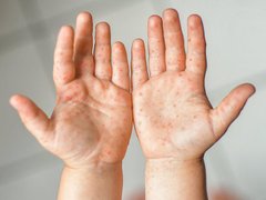 Đọc nhanh bài viết 1035900