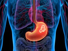 Đọc nhanh bài viết 1036233