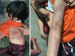 Đọc nhanh bài viết 1036665