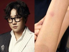 Đọc nhanh bài viết 1036685