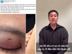 Đọc nhanh bài viết 1036806