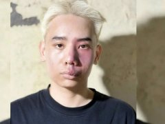 Đọc nhanh bài viết 1036829