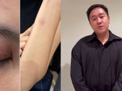 Đọc nhanh bài viết 1036919